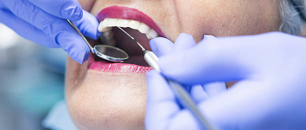 Best Emergency Treatment for Oral Infections in Calhoun Falls, SC
